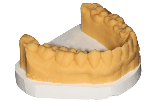 Linwood Dental Care: Dental Impressions
