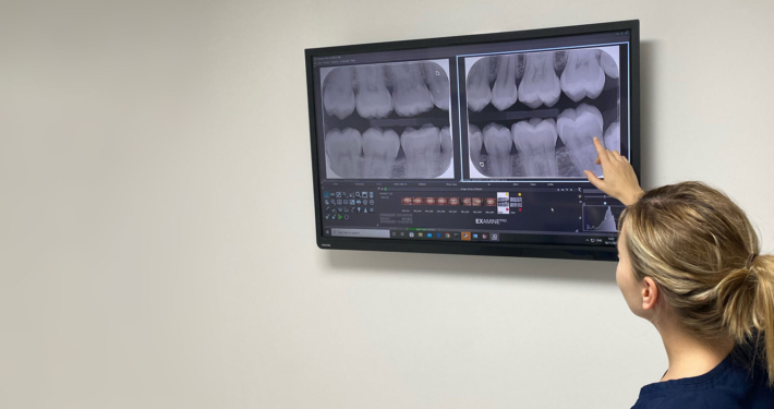 Linwood Dental Care: Digital X-Rays
